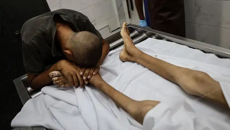 Gazze'de Çocukların Açlıkla Sınavı: Bir Hayat Daha Kaybedildi